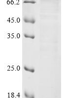 Human Xylosyltransferase 2 (XYLT2), partial Recombinant Protein - BioCrest Sci