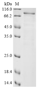 Human Xylosyltransferase 2 (XYLT2), partial Recombinant Protein, Homo sapiens (Human), Yeast, C-terminal 6xHis-tagged, 93.9 kDa, purity >≥ 85% as determined by SDS-PAGE.
