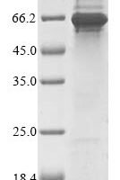 Mouse Extracellular serine/threonine protein kinase FAM20C (Fam20c) Recombinant Protein - BioCrest Sci