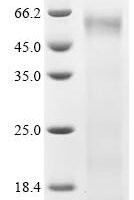 Human Interferon-induced, double-stranded RNA-activated protein kinase (EIF2AK2) Recombinant Protein, N-His - BioCrest Sci