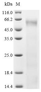Human Interferon-induced, double-stranded RNA-activated protein kinase (EIF2AK2) Recombinant Protein, N-His, Homo sapiens (Human), Yeast, N-terminal 6xHis-tagged, 63.2 kDa, purity >≥ 95% as determined by SDS-PAGE.