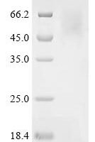 Ustilaginoidea virens Phosphoacetylglucosamine mutase Recombinant Protein, C-His, aa 1–538, Yeast - BioCrest Sci