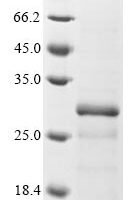 Human Thiol S-methyltransferase TMT1B (TMT1B) Recombinant Protein - BioCrest Sci