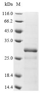 Human Thiol S-methyltransferase TMT1B (TMT1B) Recombinant Protein, Homo sapiens (Human), E.coli, N-terminal 6xHis-tagged, 29.3 kDa, purity >≥ 85% as determined by SDS-PAGE.