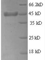Rat Thrombopoietin (Thpo), partial Recombinant Protein - BioCrest Sci