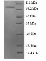 Human Heat shock 70 kDa protein 6 (HSPA6), partial Recombinant Protein - BioCrest Sci