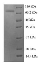 Human Heat shock 70 kDa protein 6 (HSPA6), partial Recombinant Protein, Homo sapiens (Human), E.coli, N-terminal 6xHis-tagged, 74.3 kDa, purity >≥ 90% as determined by SDS-PAGE.