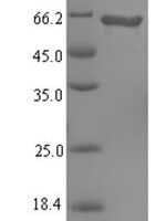 Pseudomonas aeruginosa L-ornithine 5-monooxygenase (pvdA) Recombinant Protein - BioCrest Sci