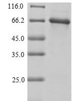 Mouse Vitamin D-binding protein (Gc) Recombinant Protein - BioCrest Sci
