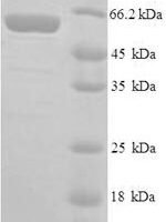 Mouse E3 ubiquitin-protein ligase Mdm2 (Mdm2) Recombinant Protein - BioCrest Sci