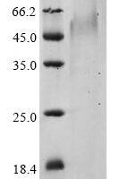 Human coronavirus HKU1 Spike glycoprotein (S), partial Recombinant Protein, C-His, aa 310–622, UniProt Q14EB0 - BioCrest Sci