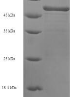 Human Sarcoplasmic/endoplasmic reticulum calcium ATPase 2 (ATP2A2), partial Recombinant Protein, N-His - BioCrest Sci