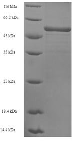 Human Sarcoplasmic/endoplasmic reticulum calcium ATPase 2 (ATP2A2), partial Recombinant Protein, N-His, Homo sapiens (Human), E.coli, N-terminal 6xHis-tagged, 52.3 kDa, purity >≥ 90% as determined by SDS-PAGE.