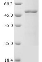 Mycobacterium tuberculosis Cell division protein FtsZ (ftsZ) Recombinant Protein - BioCrest Sci