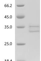 Human Neutrophil elastase (ELANE), partial Recombinant Protein, C-10His - BioCrest Sci