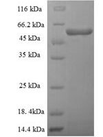 Human Threonine--tRNA ligase, mitochondrial (TARS2), partial Recombinant Protein - BioCrest Sci
