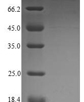 Human immunodeficiency virus type 2 subtype A Protein Vpx (vpx),Yeast Recombinant Protein - BioCrest Sci