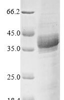 Mouse Max dimerization protein 1 (Mxd1) Recombinant Protein - BioCrest Sci