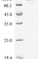 Human adenovirus C serotype 5 Pre-histone-like nucleoprotein (L2), partial Recombinant Protein - BioCrest Sci