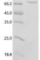 Bovine albumin (ALB) Recombinant Protein - BioCrest Sci