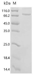 Bovine albumin (ALB) Recombinant Protein, Bos taurus (Bovine), E.coli, N-terminal 6xHis-tagged, 73.4 kDa, purity >≥ 95% as determined by SDS-PAGE.