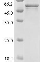 Human Aromatase (CYP19A1) Recombinant Protein - BioCrest Sci