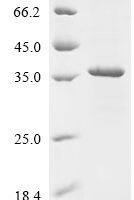 Rat Lutropin-choriogonadotropic hormone receptor (Lhcgr), partial Recombinant Protein, C-Flag, aa 27–362, E.coli - BioCrest Sci