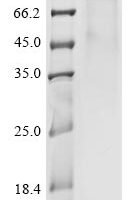 Human coronavirus HKU1 Spike glycoprotein (S), partial Recombinant Protein, C-mFC - BioCrest Sci