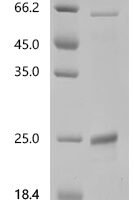 Mouse Bone morphogenetic protein 15 (Bmp15) Recombinant Protein, C-His - BioCrest Sci