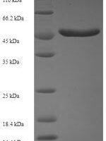 Human Serine/threonine-protein kinase PAK 5 (PAK5), partial Recombinant Protein, N-His-SUMO - BioCrest Sci