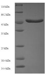 Human Serine/threonine-protein kinase PAK 5 (PAK5), partial Recombinant Protein, N-His-SUMO, Homo sapiens (Human), E.coli, N-terminal 6xHis-SUMO-tagged, 49.5 kDa, purity >≥ 90% as determined by SDS-PAGE.