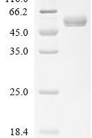 Mouse Cardiotrophin-1 (Ctf1) Recombinant Protein, N-hFc1 - BioCrest Sci