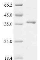 Human C-C motif chemokine 20 (CCL20), partial Recombinant Protein, N-His-GST - BioCrest Sci