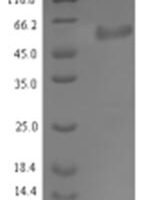 Staphylococcus aureus Serine-aspartate repeat-containing protein E (sdrE), partial Recombinant Protein - BioCrest Sci