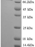 Thermus aquaticus DNA polymerase I, thermostable (polA), partial Recombinant Protein, N-GST, aa 571–832 - BioCrest Sci