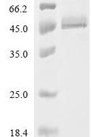 Human Protein NDRG1 (NDRG1)(S336D,T346D) Recombinant Protein, C-10His - BioCrest Sci