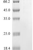 Severe acute respiratory syndrome coronavirus 2 Replicase polyprotein 1ab (rep), partial Recombinant Protein, N-GST - BioCrest Sci