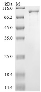 Severe acute respiratory syndrome coronavirus 2 Replicase polyprotein 1ab (rep), partial Recombinant Protein, N-GST, Severe acute respiratory syndrome coronavirus 2 (2019-nCoV) (SARS-CoV-2), Yeast, N-terminal GST-tagged, 92.3 kDa, purity >≥ 85% as determined by SDS-PAGE.