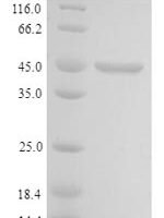 Human Cell growth-regulating nucleolar protein (LYAR) Recombinant Protein - BioCrest Sci