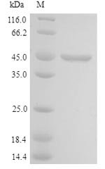 Human Cell growth-regulating nucleolar protein (LYAR) Recombinant Protein, Homo sapiens (Human), Yeast, N-terminal 6xHis-tagged, 45.6 kDa, purity >≥ 90% as determined by SDS-PAGE.