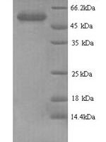 Escherichia coli Aerobic glycerol-3-phosphate dehydrogenase (glpD) Recombinant Protein, N-His, aa 1–501, Yeast - BioCrest Sci