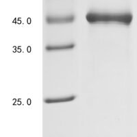 Human Low affinity immunoglobulin gamma Fc region receptor III-B (FCGR3B), partial Recombinant Protein - BioCrest Sci
