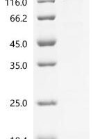 Human Protein turtle homolog A（IGSF9), partial Recombinant Protein - BioCrest Sci