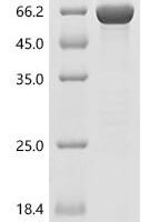 Human Arylsulfatase K (ARSK) Recombinant Protein - BioCrest Sci