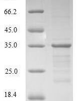 Human Non-histone chromosomal protein HMG-17 (HMGN2) Recombinant Protein - BioCrest Sci