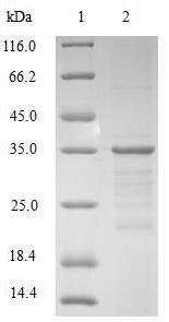 Human Non-histone chromosomal protein HMG-17 (HMGN2) Recombinant Protein, Homo sapiens (Human), E.coli, N-terminal GST-tagged, 36.4 kDa, purity >≥ 90% as determined by SDS-PAGE.