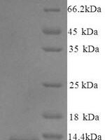 Mouse Guanylate cyclase activator 2B (Guca2b) Recombinant Protein, N-His - BioCrest Sci