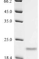 Trachypithecus cristatus Cytochrome c oxidase subunit 7A1, mitochondrial (COX7A1), partial Recombinant Protein, N-His-SUMOstar - BioCrest Sci