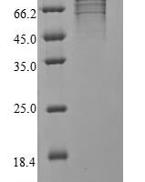 Severe acute respiratory syndrome coronavirus 2 Nucleoprotein (N) Recombinant Protein, N-His-PDI - BioCrest Sci