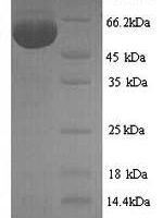 Influenza A virus Nucleoprotein (NP) Recombinant Protein, N-His, aa 1–498, strain A/Puerto Rico/8/1934 H1N1 - BioCrest Sci